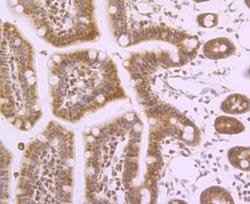 Nav1.7 Rabbit anti-Human, Polyclonal, Novus Biologicals 100 &mu;l; Unconjugated:Antibodies,